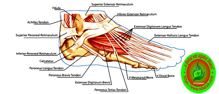 Achilles Tendon Rupture; Causes, Symptoms, Test, Treatment Achilles Tendon Rupture; Causes, Symptoms, Test, Treatment