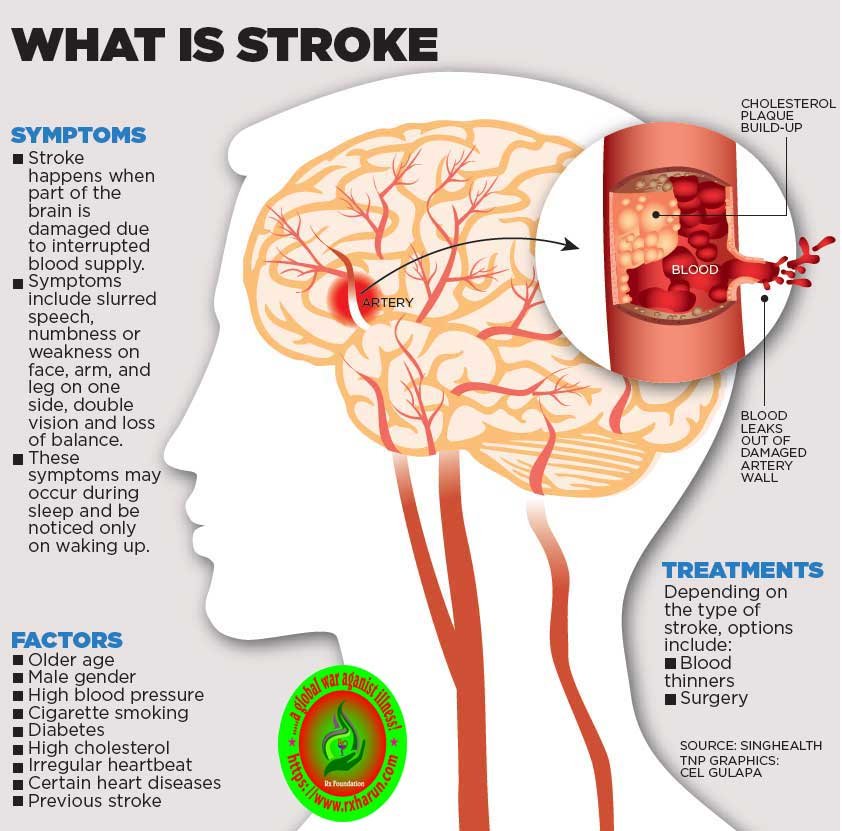 What happens to your body when you have a stroke?early Sign