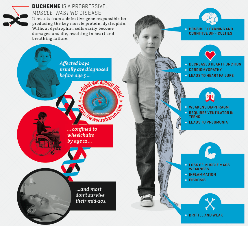 Duchenne Muscular Dystrophy - Causes, Symptoms, Treatment