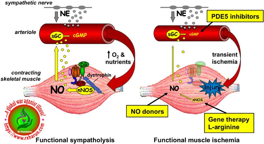 Duchenne Muscular Dystrophy - Causes, Symptoms, Treatment