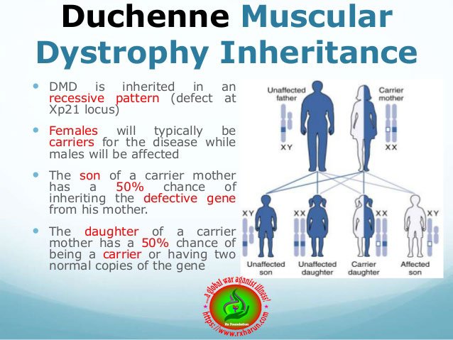 Duchenne Muscular Dystrophy - Causes, Symptoms, Treatment