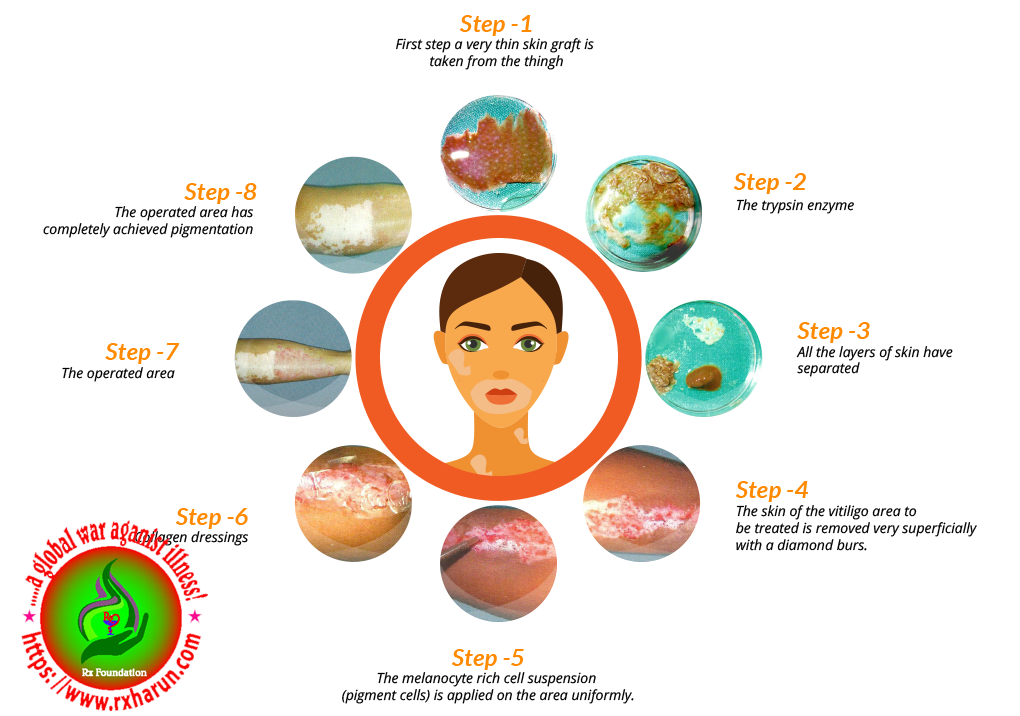 Skin Fading; Causes, Symptoms, Diagnosis, Treatment