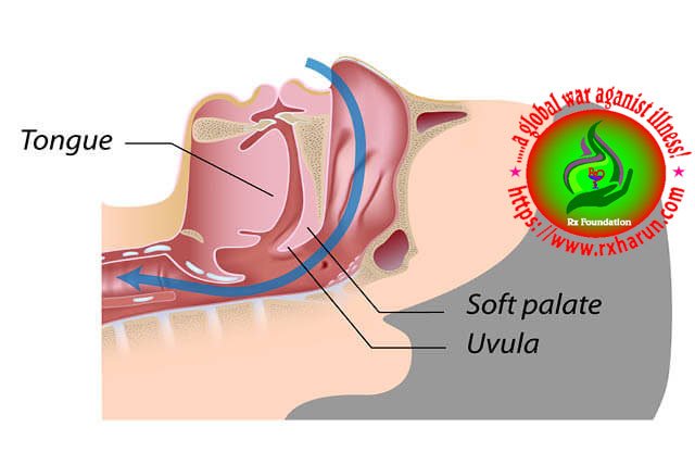 Deep Vein Thrombosis; Symptoms, Diagnosis, Treatment