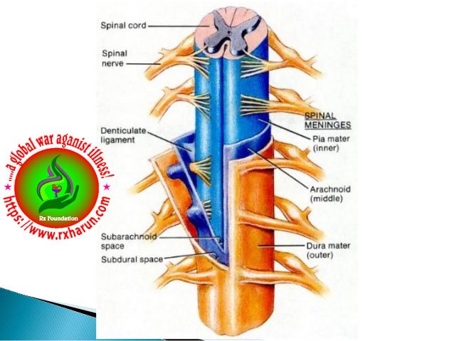 What Is PLID ? Symptoms, Diagnosis, Treatment