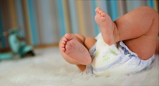 Napkin Dermatitis, Causes, Symptoms, Treatment