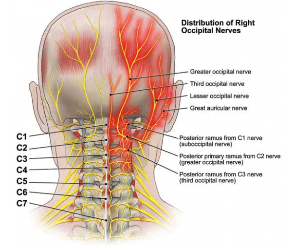 Treatment of Atlanto-occipital Dislocation