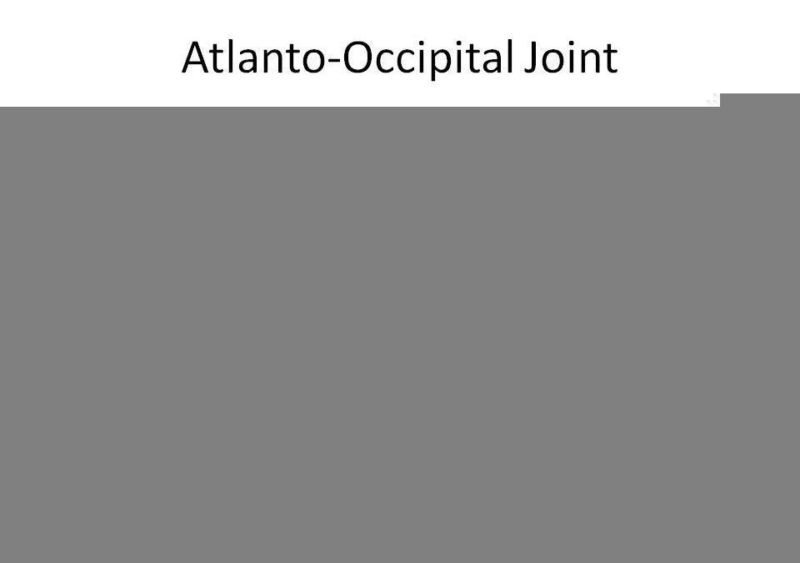 Treatment of Atlanto-occipital Dislocation