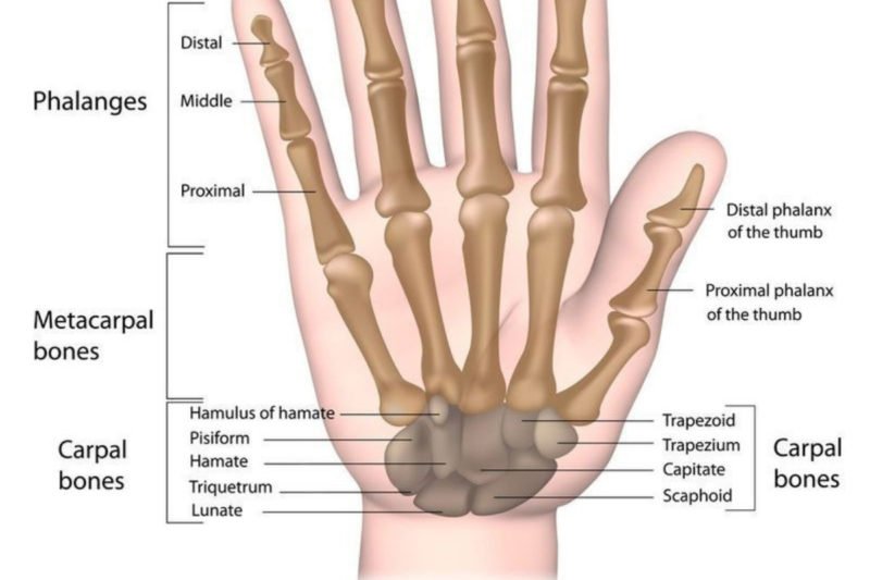 Avascular Necrosis of the Lunate - Symptoms, Treatment