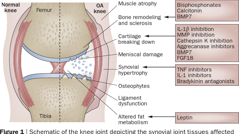 First Symptoms Of Knee Joints Osteoarthritis