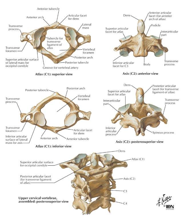 C2 - C3 Vertebrae Fracture - Symptoms, Diagnosis, Treatment