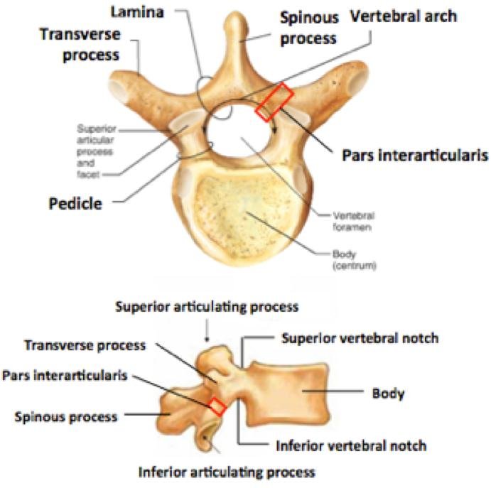Pars Interarticularis Injury  - Causes, Symptoms, Treatment