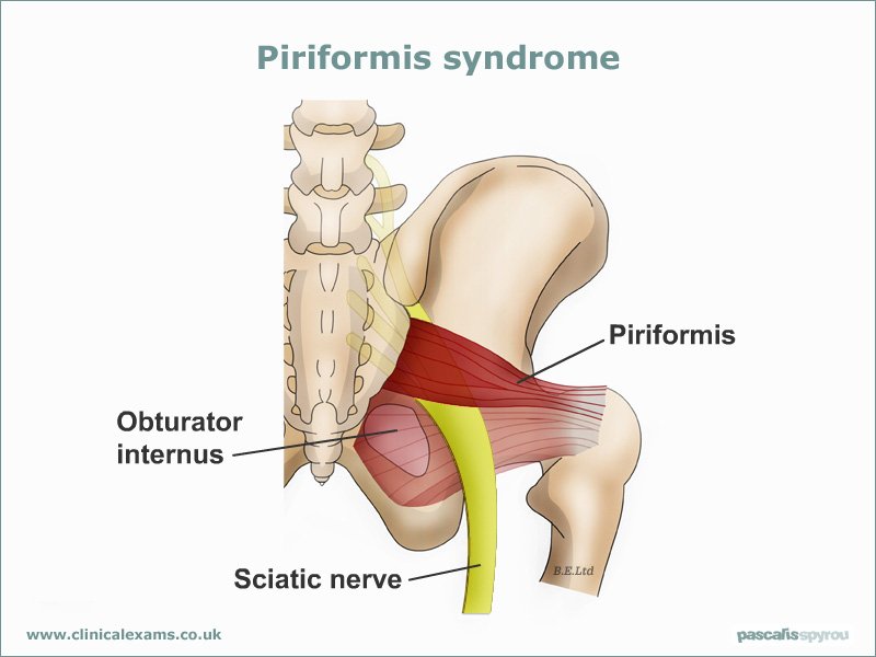 Obturator Internus Muscle - Origin, Nerve Supply, Function