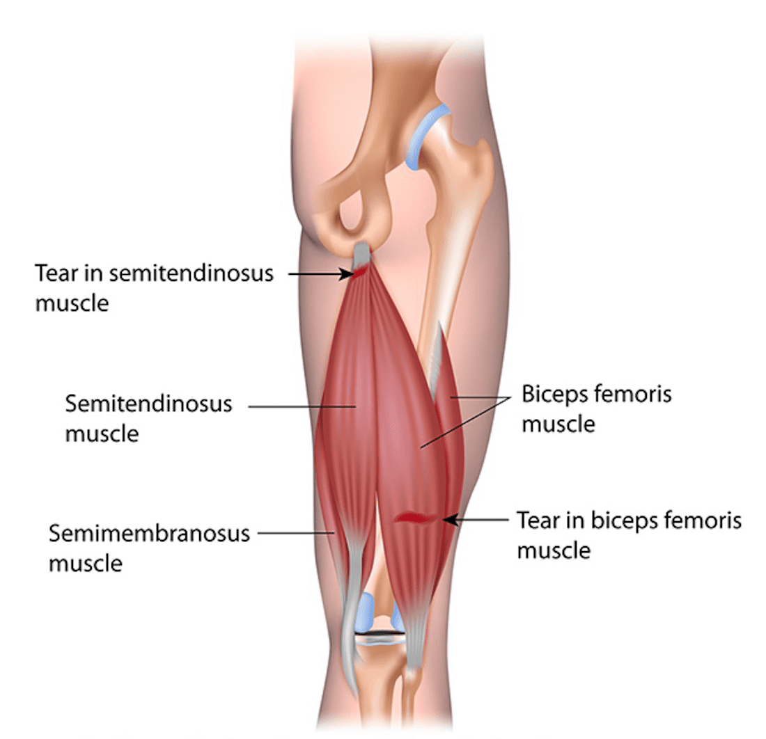 Semimembranosus - Origin, Nerve Blood Supply, Function