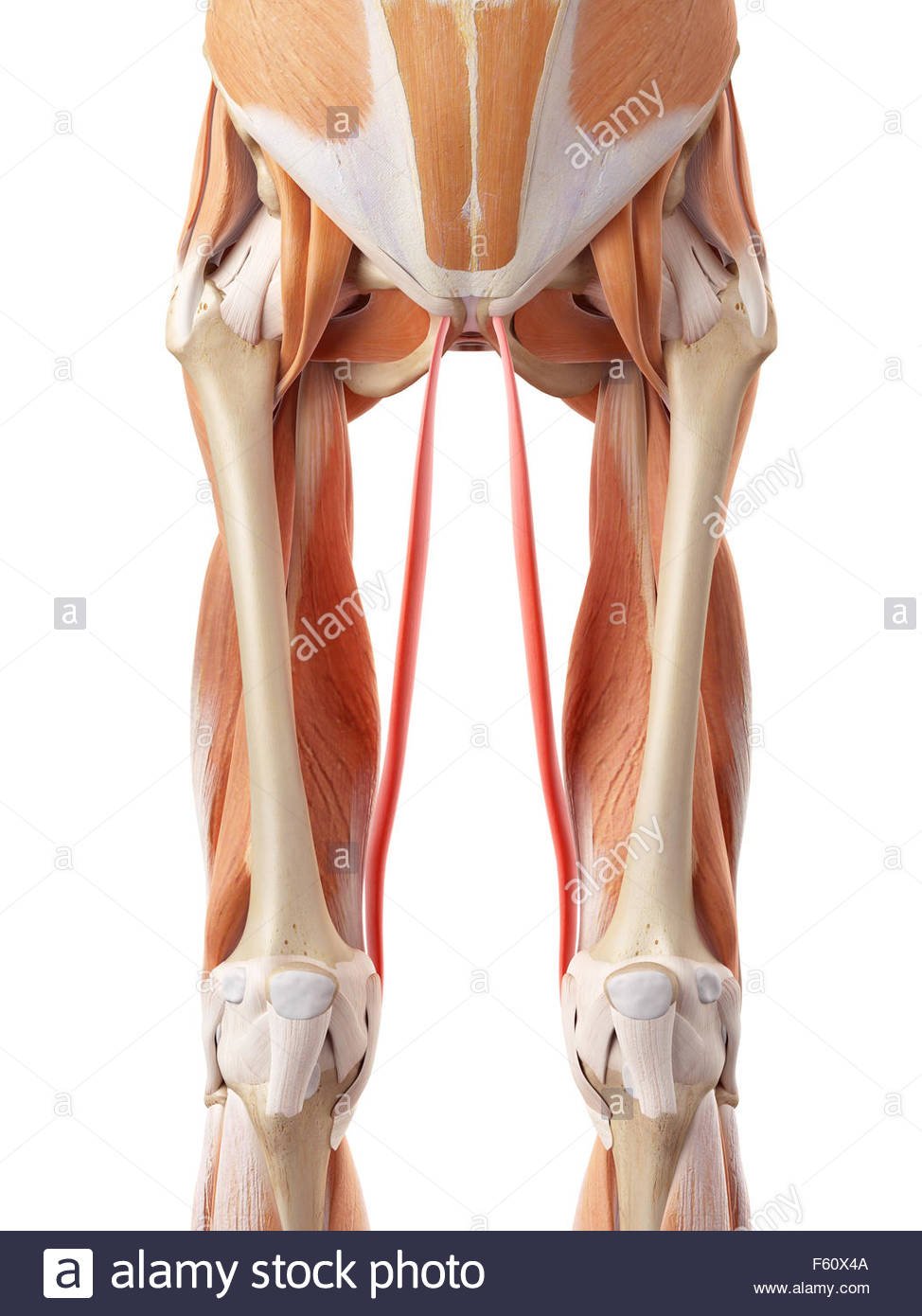 Degenerative Osteoarthritis of Knee