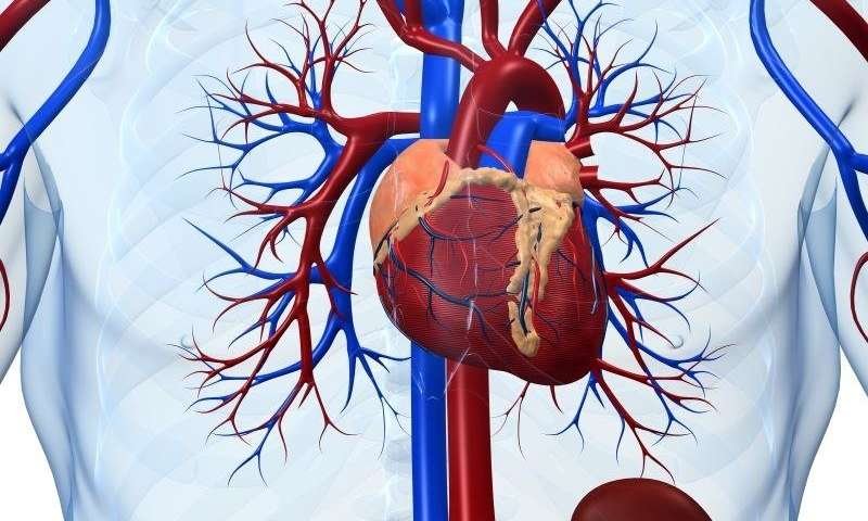 Acute Myocardial Infarction - Causes, Symptoms, Treatment