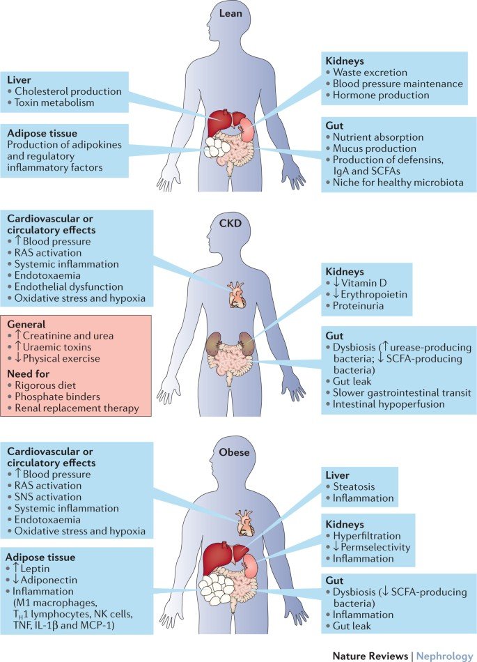 Kidney Transplant - Causes, Indications, Treatment