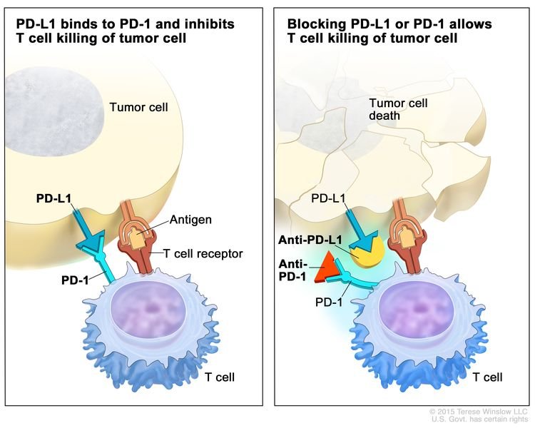 Anal Cancer - Causes, Symptoms, Diagnosis, Treatment Anal Cancer - Causes, Symptoms, Diagnosis, Treatment