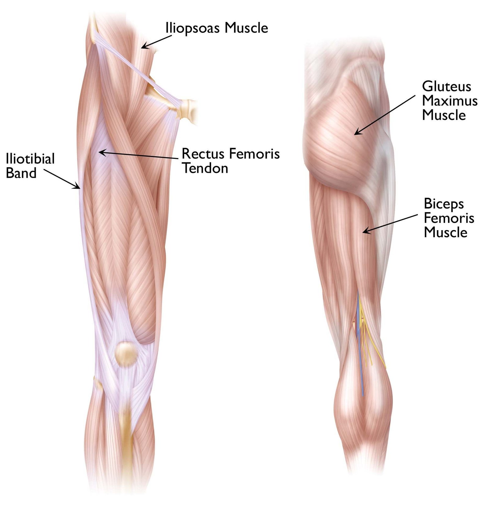 Snapping Hip - Causes, Symptoms, Diagnosis, Treatment