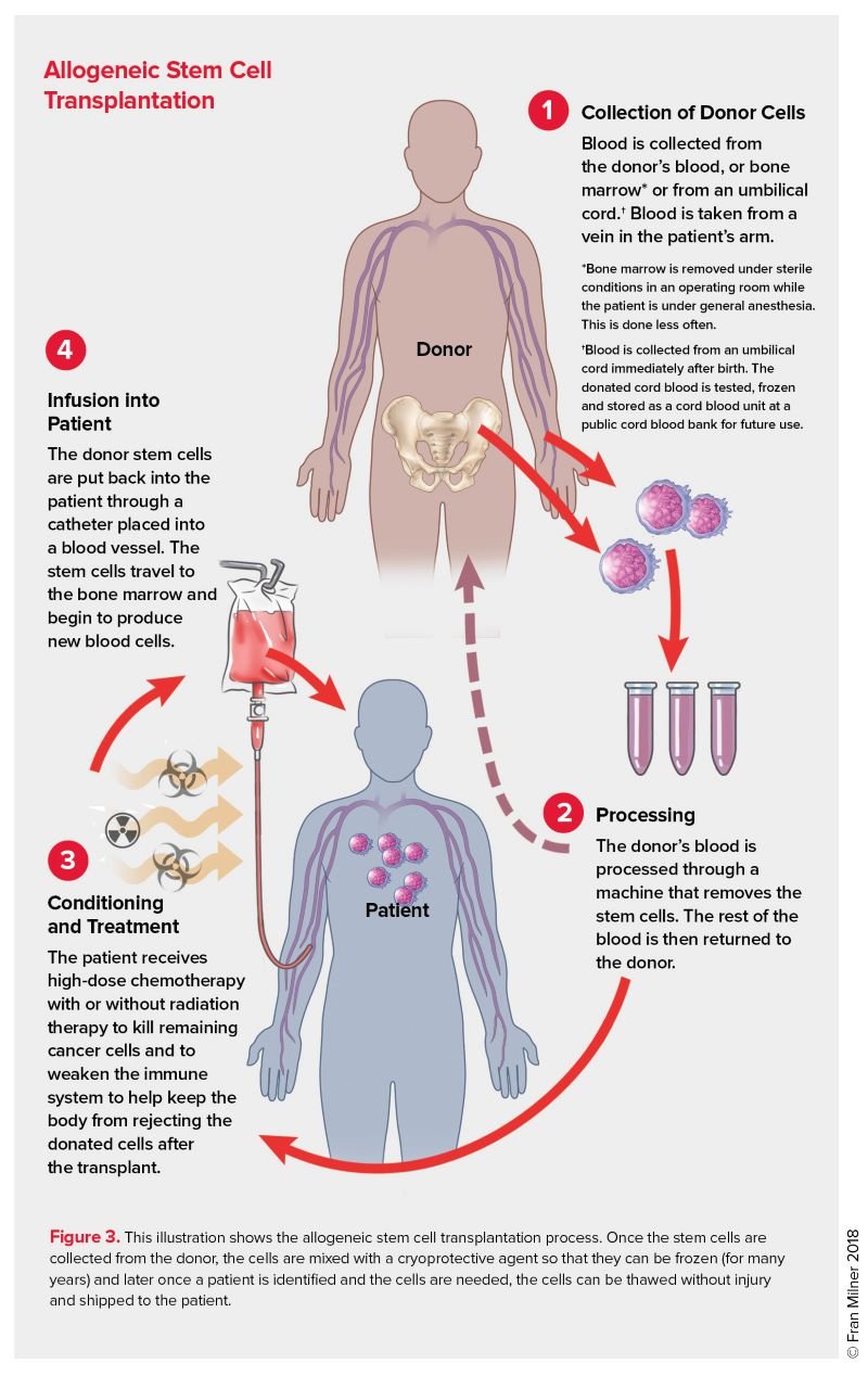 Bone Marrow Transplant - Indications, Contraindications