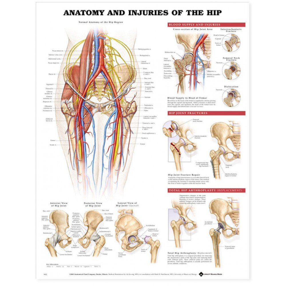 What Is Total Hip Arthroplasty?