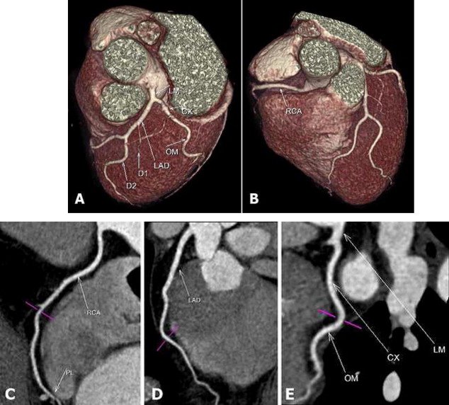 MSCT Scan