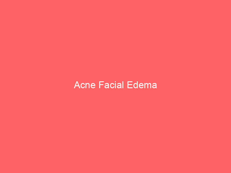 Acne Facial Edema