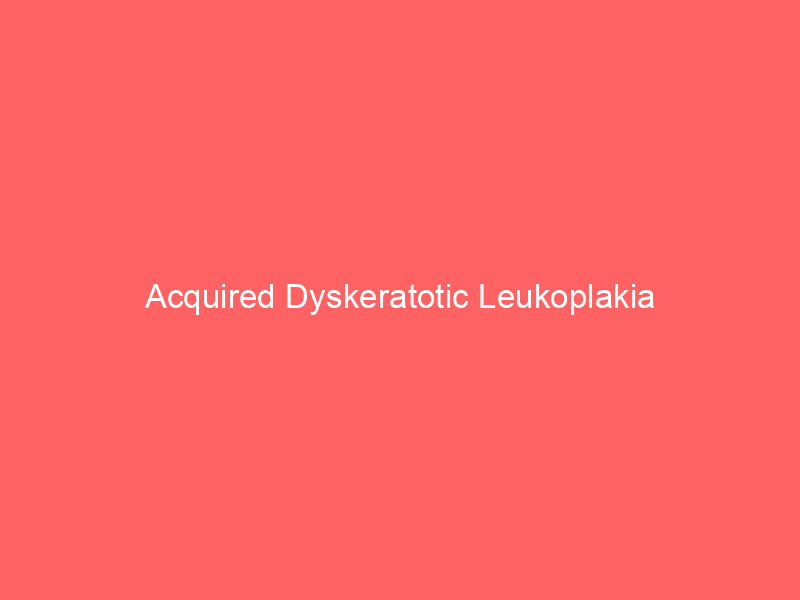 Acquired Dyskeratotic Leukoplakia