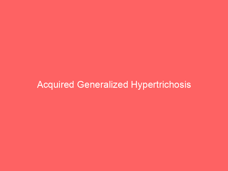 Acquired Generalized Hypertrichosis