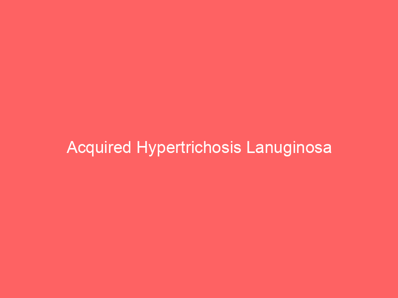 Acquired Hypertrichosis Lanuginosa
