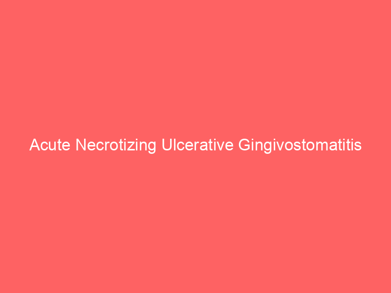 Acute Necrotizing Ulcerative Gingivostomatitis