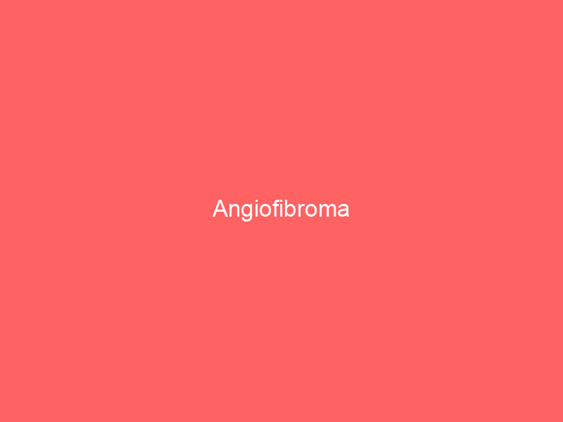 Angiofibroma