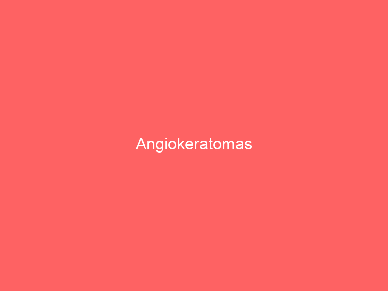 Angiokeratomas