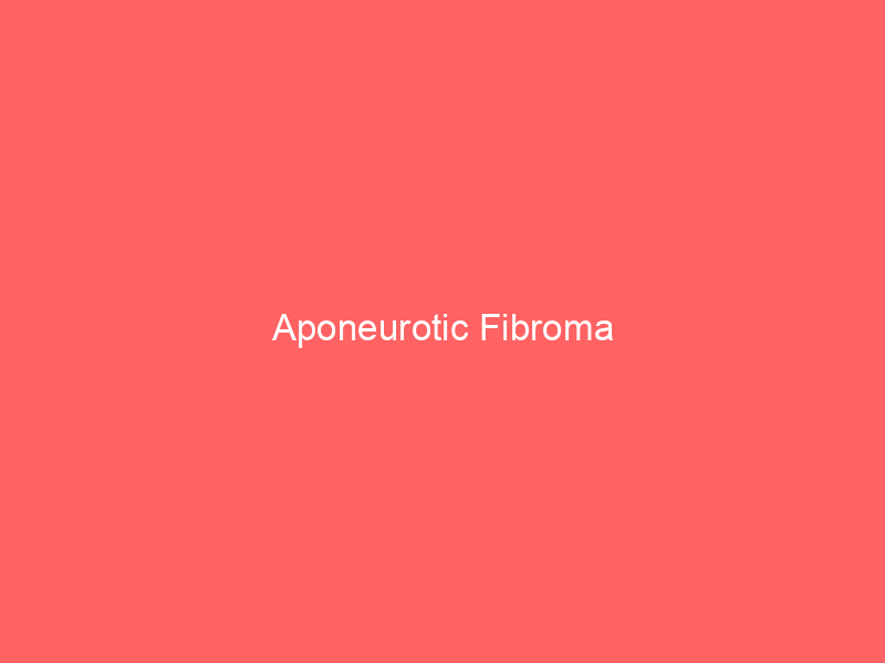 Aponeurotic Fibroma