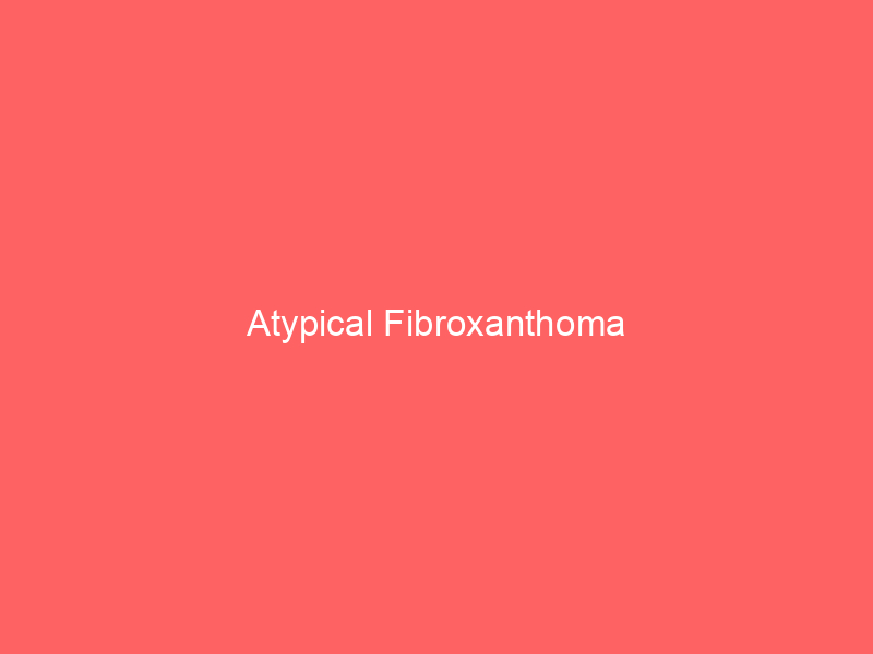 Atypical Fibroxanthoma