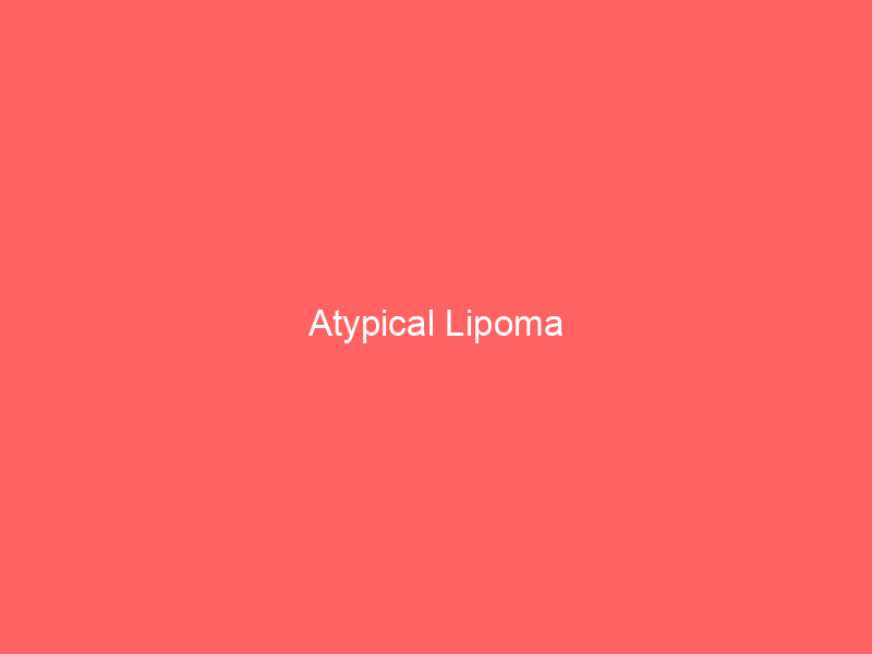 Atypical Lipoma