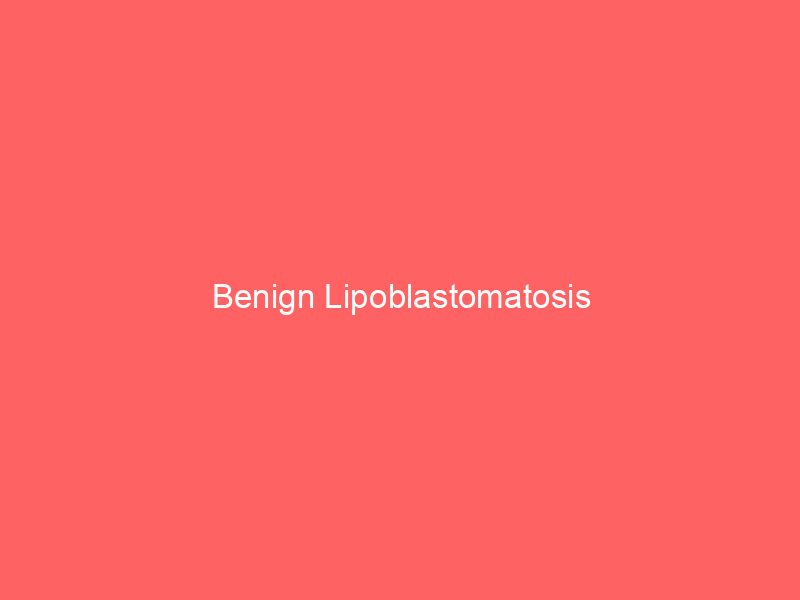 Benign Lipoblastomatosis