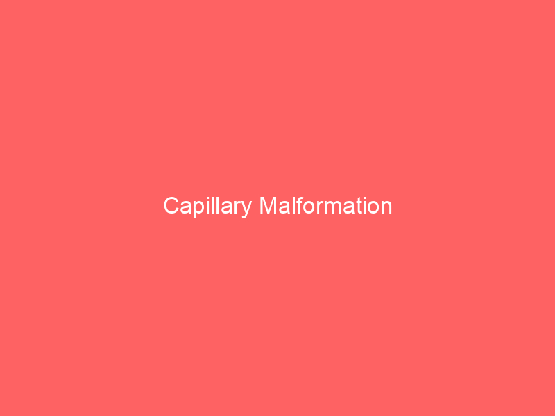 Capillary Malformation