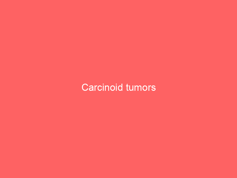 Carcinoid tumors