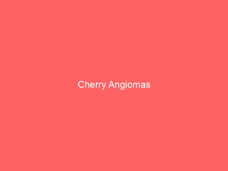 Cherry Angiomas