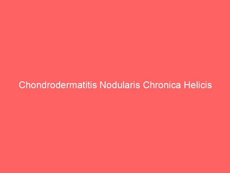 Chondrodermatitis Nodularis Chronica Helicis