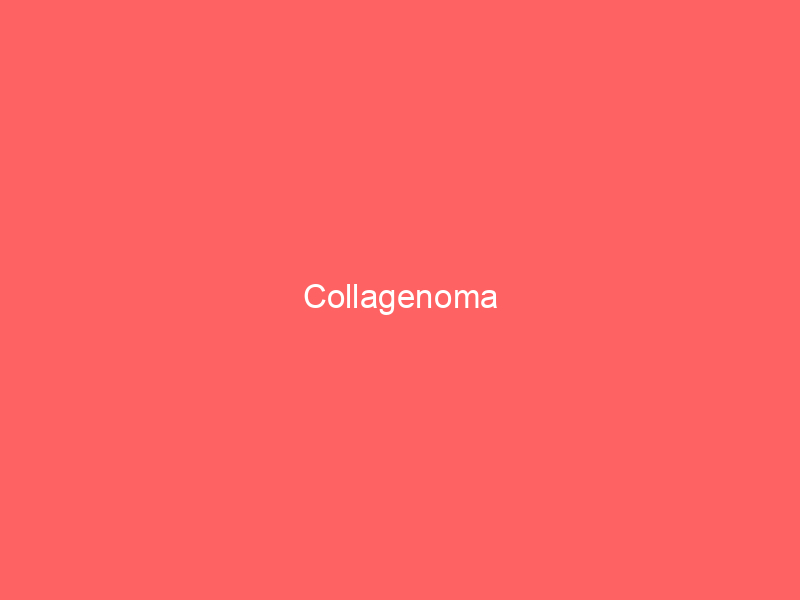 Collagenoma