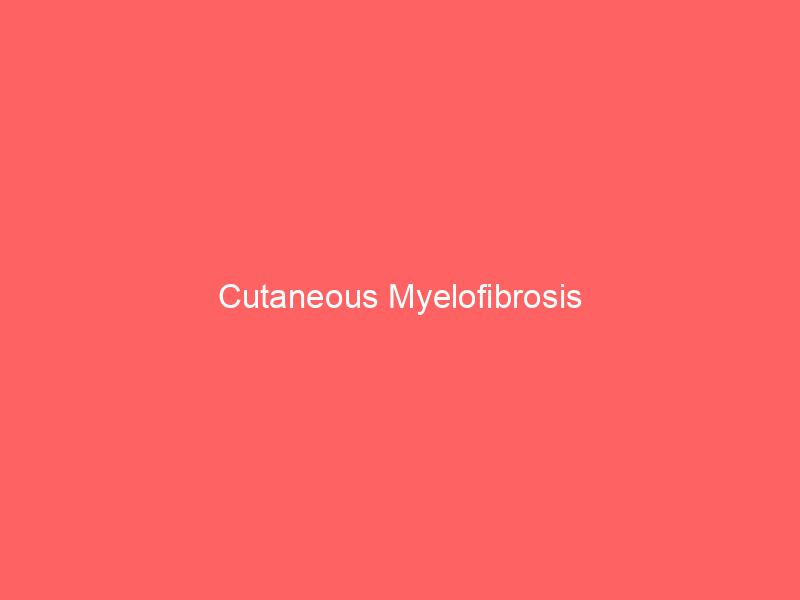 Cutaneous Myelofibrosis