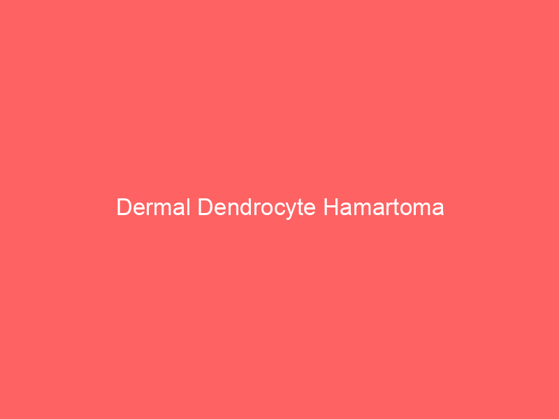 Dermal Dendrocyte Hamartoma