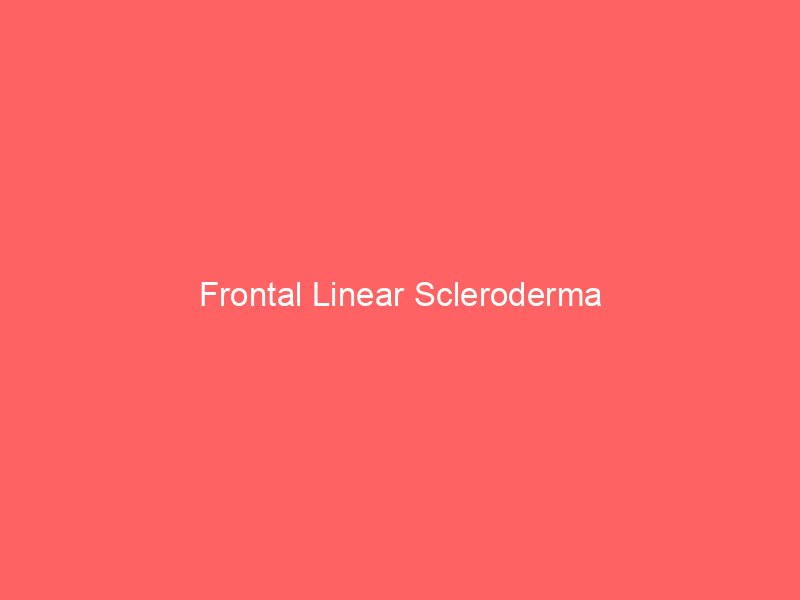 Frontal Linear Scleroderma