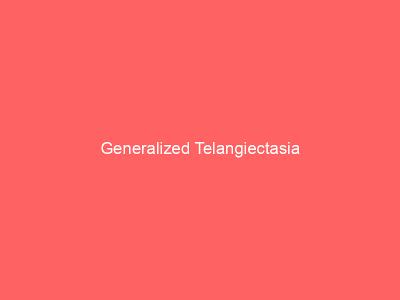 Generalized Telangiectasia