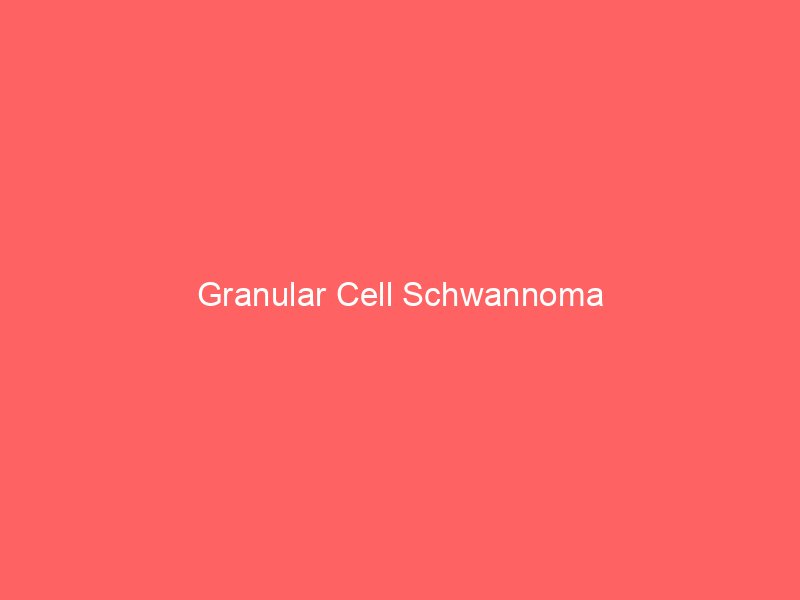 Granular Cell Schwannoma