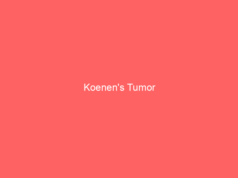Koenen’s Tumor