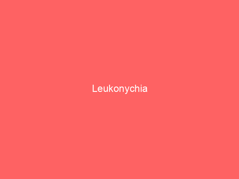 Leukonychia