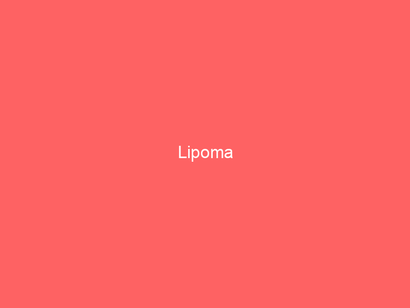 Lipoma