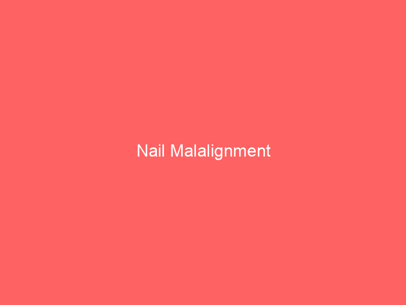 Nail Malalignment